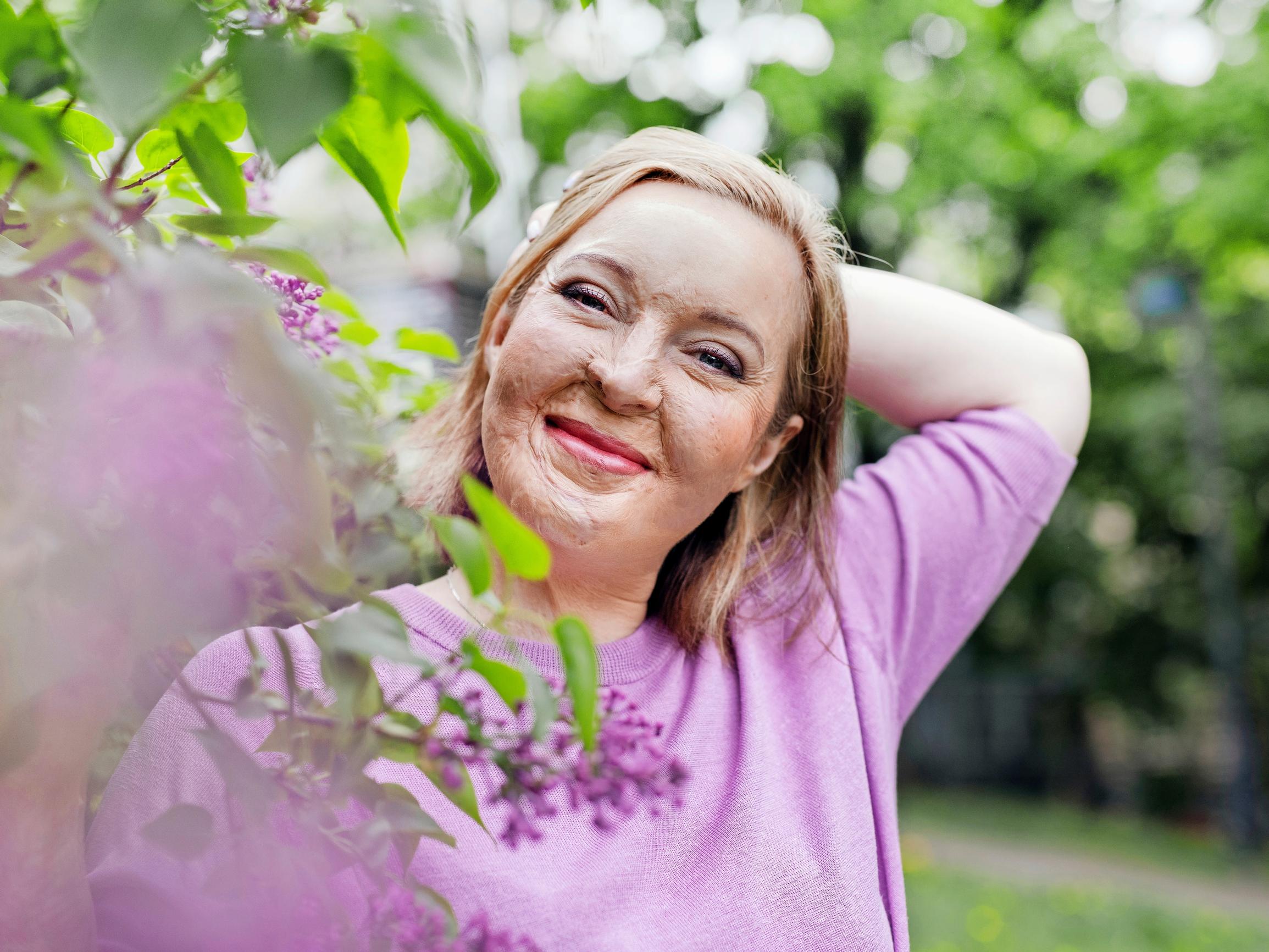Rajusta onnettomuudesta selvinnyt Ulrika: ”Ympärilläni oli ihmisiä, jotka uskoivat minuun silloinkin, kun en itse olisi jaksanut”